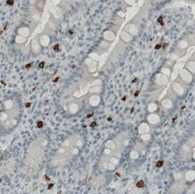 Immunohistochemistry-Paraffin: CD117/c-kit Antibody (CL1667) [NBP2-34487]
