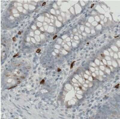 Immunohistochemistry-Paraffin: CD117/c-kit Antibody (CL1667) [NBP2-34487]