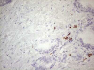 Immunohistochemistry: CD117/c-kit Antibody (OTI2B12) - Azide and BSA Free [NBP2-71076]