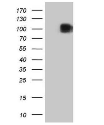 Western Blot: CD117/c-kit Antibody (OTI2B12)Azide and BSA Free [NBP2-71076]