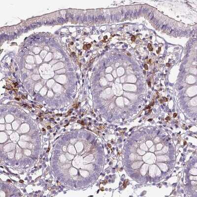 Immunohistochemistry-Paraffin: CD11b Antibody (CL1719) [NBP2-34490]