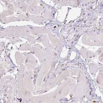Immunohistochemistry-Paraffin: CD11b Antibody (CL1719) [NBP2-34490]