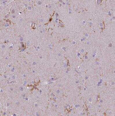 Immunohistochemistry-Paraffin: CD11b Antibody (CL1719) [NBP2-34490]