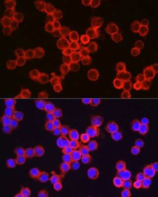 Immunocytochemistry/ Immunofluorescence: CD11b Antibody - Azide and BSA Free [NBP2-92978]