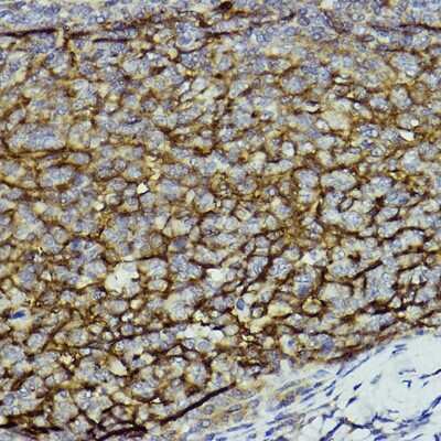 Immunohistochemistry-Paraffin: CD11b Antibody - Azide and BSA Free [NBP2-92978]