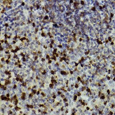 Immunohistochemistry-Paraffin: CD11b Antibody - Azide and BSA Free [NBP2-92978]