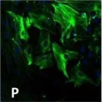 Immunocytochemistry/ Immunofluorescence: CD11b/c Antibody - BSA Free [NB110-40766]