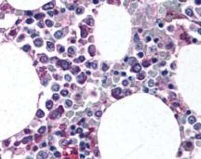 Immunohistochemistry: CD11b/c Antibody - BSA Free [NB110-40766]