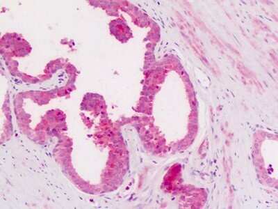 Immunohistochemistry-Paraffin: CD11c Antibody - BSA Free [NB110-55523]