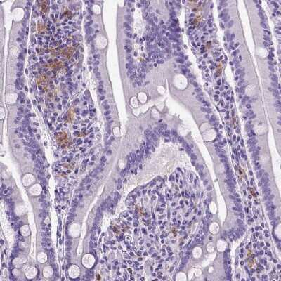 Immunohistochemistry-Paraffin: CD11c Antibody (CL1831) [NBP2-34491]