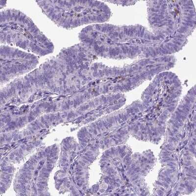 Immunohistochemistry-Paraffin: CD11c Antibody (CL1831) [NBP2-34491]