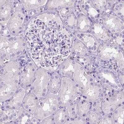 Immunohistochemistry-Paraffin: CD11c Antibody (CL1831) [NBP2-34491]