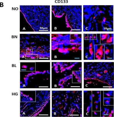 Immunohistochemistry: CD133 Antibody - BSA Free [NB120-16518]