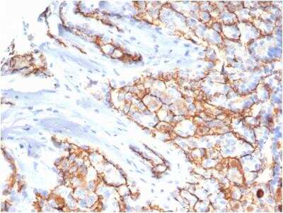Immunohistochemistry-Paraffin: CD133 Antibody (PROM/6316) - Azide and BSA Free [NBP3-08969]