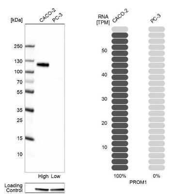 Western Blot: CD133 Antibody [NBP2-59789]