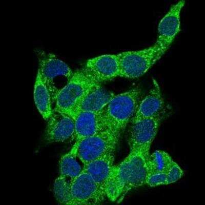Immunocytochemistry/ Immunofluorescence: CD14 Antibody (1H5D8) - BSA Free [NBP2-37295]