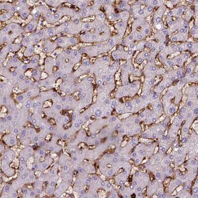 Immunohistochemistry-Paraffin: CD14 Antibody (CL1637) [NBP2-34485]