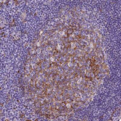 Immunohistochemistry-Paraffin: CD14 Antibody (CL1637) [NBP2-34485]