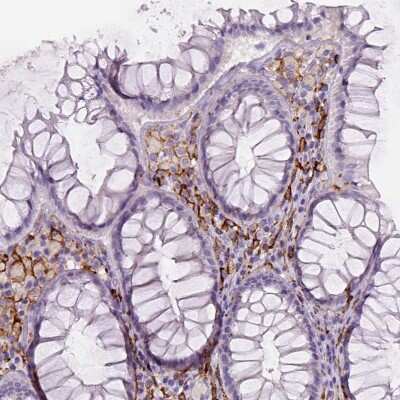Immunohistochemistry-Paraffin: CD14 Antibody (CL1637) [NBP2-34485]