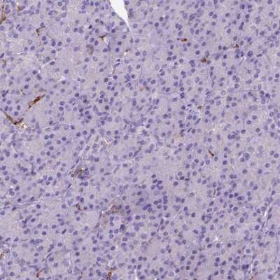 Immunohistochemistry-Paraffin: CD14 Antibody (CL1637) [NBP2-34485]