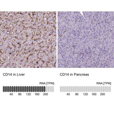 Immunohistochemistry-Paraffin: CD14 Antibody (CL1637) [NBP2-34485]