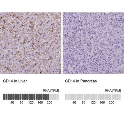 Immunohistochemistry-Paraffin: CD14 Antibody (CL1638) [NBP2-34486]