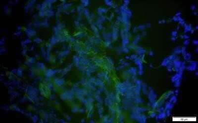 Immunocytochemistry/ Immunofluorescence: CD14 Antibody (M5E2) - Azide and BSA Free [NBP2-80627]