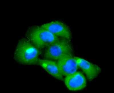 Immunocytochemistry/ Immunofluorescence: CD14 Antibody (SC69-02) [NBP2-67630]