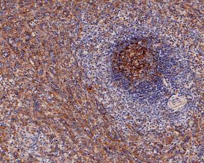 Immunohistochemistry-Paraffin: CD14 Antibody (SC69-02) [NBP2-67630]