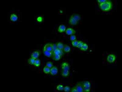 Immunocytochemistry/ Immunofluorescence: EMMPRIN/CD147 Antibody (OTI9H5) [NBP2-02534]