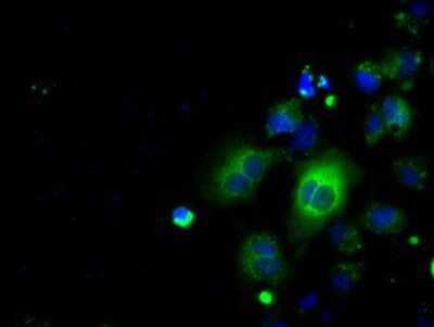 Immunocytochemistry/ Immunofluorescence: EMMPRIN/CD147 Antibody (OTI9H5) [NBP2-02534]