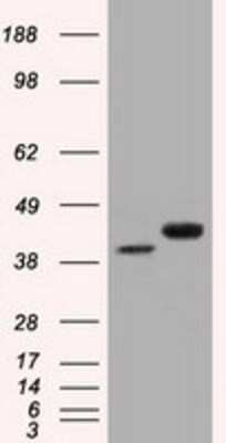 Western Blot: EMMPRIN/CD147 Antibody (OTI9H5) [NBP2-02534]