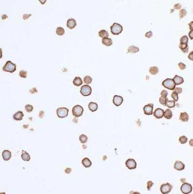 Immunocytochemistry/ Immunofluorescence: CD155/PVR Antibody (BLR074G) [NBP2-78711]