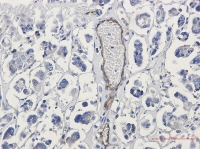 Immunohistochemistry-Paraffin: CD155/PVR Antibody (S04-2C7) [NBP3-19998]