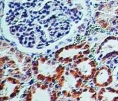 Immunohistochemistry-Paraffin: CD161 Antibody (14F1F11) - BSA Free [NBP2-14845]