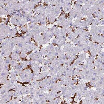 Immunohistochemistry-Paraffin: CD163 Antibody [NBP2-48846]