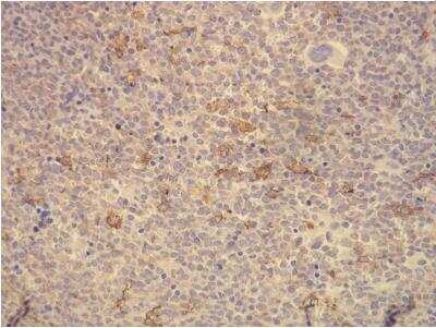 Immunohistochemistry-Paraffin: CD163 Antibody (K20-T) [NBP1-30148]