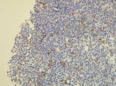 Immunohistochemistry-Paraffin: CD163 Antibody (K20-T) [NBP1-30148]