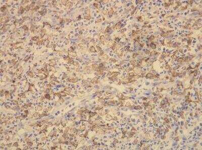 Immunohistochemistry-Paraffin: CD163 Antibody (K20-T) [NBP1-30148]