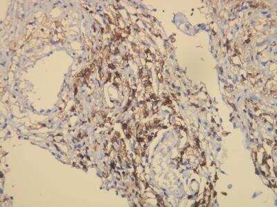 Immunohistochemistry-Paraffin: CD163 Antibody (K20-T) [NBP1-30148]