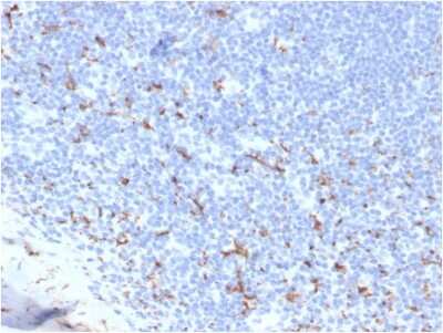 Immunohistochemistry-Paraffin: CD163 Antibody (M130/3708R) [NBP3-07572]