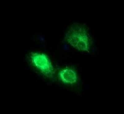 Immunocytochemistry/ Immunofluorescence: CD163 Antibody (OTI2B12) - Azide and BSA Free [NBP2-71420]