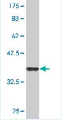 Western Blot: CD164 Antibody (4B4) [H00008763-M10]
