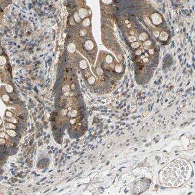 Immunohistochemistry-Paraffin: CD164 Antibody [NBP1-81159]