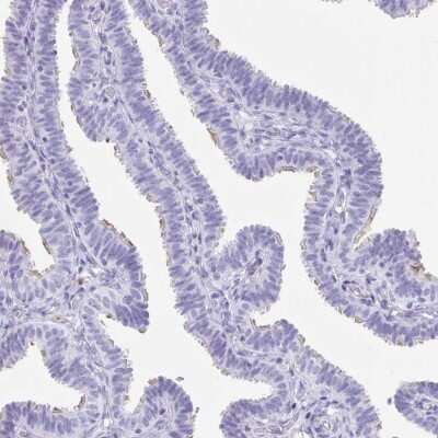 Immunohistochemistry-Paraffin: CD164L2 Antibody [NBP2-38010]