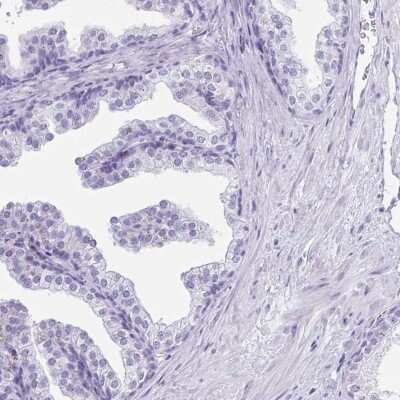 Immunohistochemistry-Paraffin: CD164L2 Antibody [NBP2-38010]