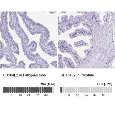 Immunohistochemistry-Paraffin: CD164L2 Antibody [NBP2-38010]