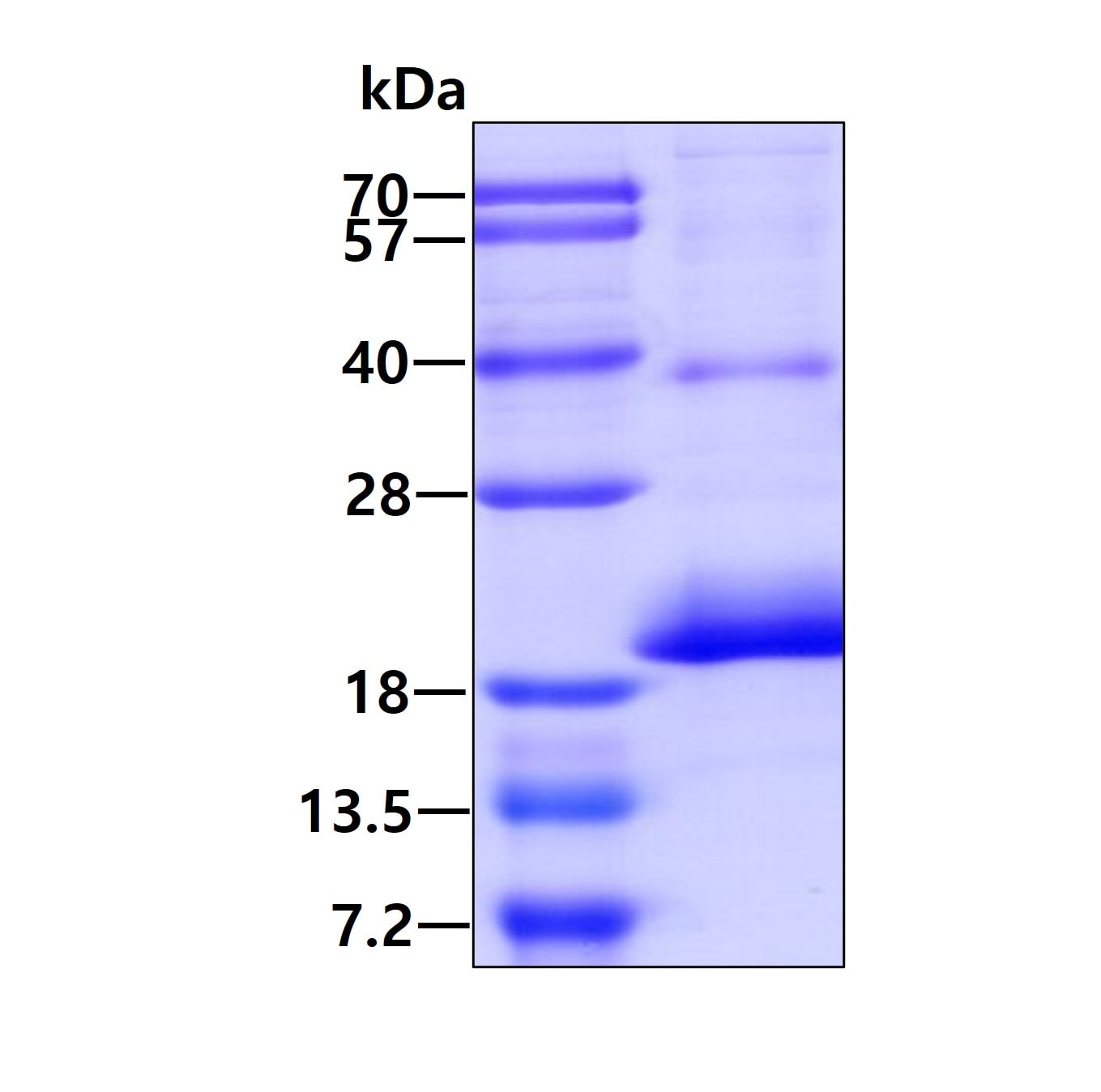 SDS-PAGE: Recombinant Human CD164L2 His Protein [NBP2-51604]