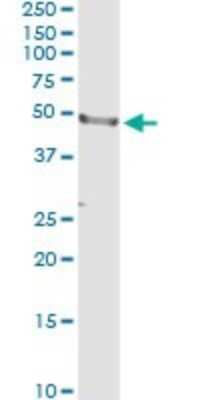 Immunoprecipitation: CD177 Antibody (4C4) [H00057126-M01]