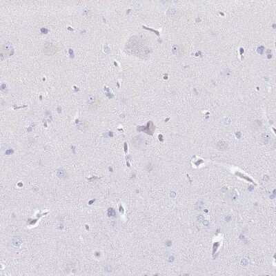 Immunohistochemistry-Paraffin: CD177 Antibody [NBP2-58979]